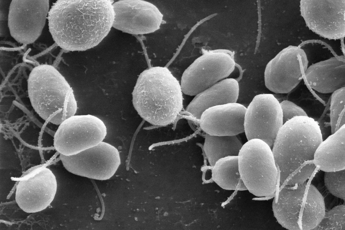 Scanning electron microscope image of oval single-celled algae with thin flagella